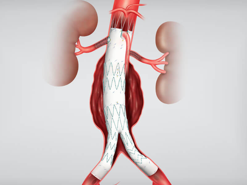 Disease-specific solutions