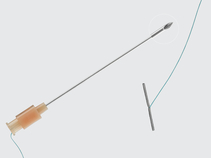 Cope Pediatric Gastrointestinal Suture Anchor