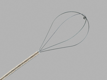 NCircle®; Tipless  Stone Extractor