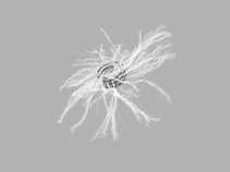MReye Embolization Coil