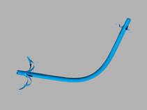 ST-2 Soehendra®; Tannenbaum®; Biliary Stent
