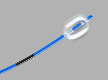 Escort II®; Double Lumen Extraction Balloon