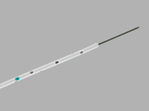 Nasal Jejunal Feeding Tubes