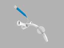 Melker Cuffed Emergency Cricothyrotomy Catheter