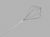 NCompass®; Nitinol Stone Extractor