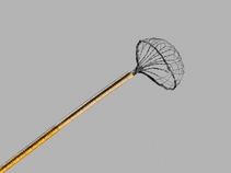 NTrap®; Stone Entrapment and Extraction Device