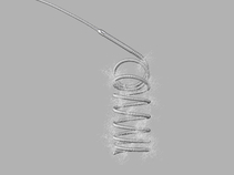 Retracta Detachable Embolization Coil