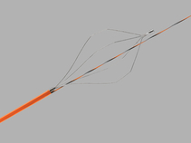 Fusion®; Lithotripsy Extraction Basket