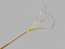 NGage Nitinol Stone Extractor