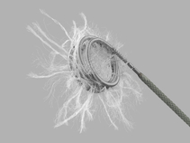 MReye Flipper Detachable Embolization Coil and Delivery System