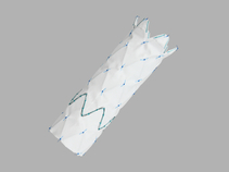 Zenith Alpha® 2 Thoracic Endovascular Graft Distal Extension