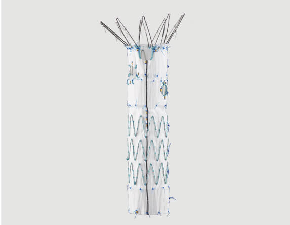 Full view of Zenith® Fenestrated proximal body graft.