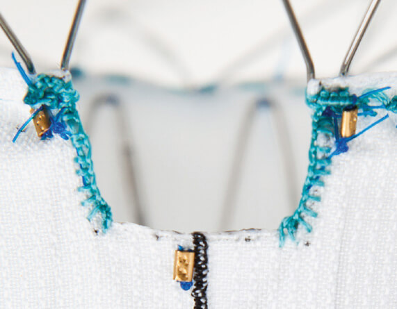 Close up of Zenith® Fenestrated endovascular graft scallop.