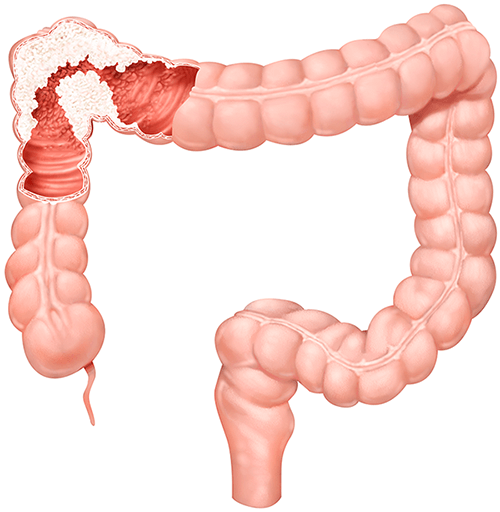 Illustration of the Colon