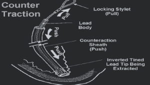 Charles Dotter Plumber Pipes Sketched